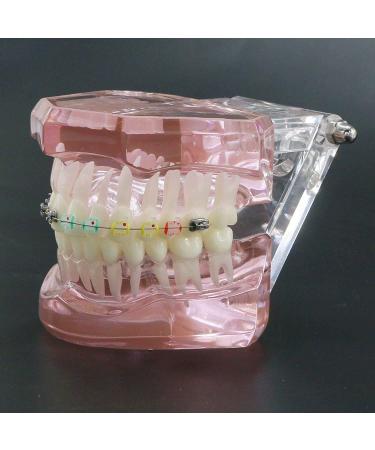 HDGRNCC Dental Orthodontic Brackets Model - Metal Ceramic Self-Ceramic Bracket for Training | International Shipping - Buy Online on GoSupps.com
