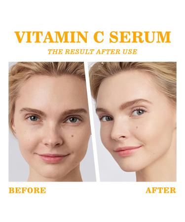 Vitamin C Face Serum & Gua Sha Tool - Anti-Aging Hydration Dark Spot Treatment with Hyaluronic Acid & Collagen - 1.05oz - Buy Online on GoSupps.com