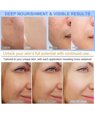 6 Pack Organic Collagen Overnight Mask Anti Aging Anti Wrinkle Anti Wrinkle Face Mask Moisturizing Night Mask - Buy Online on GoSupps.com