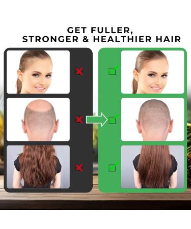 Go Ho Raw Batana Oil for Hair Growth | 100% Pure Organic Dr. Sebi Batana Oil from Honduras | Rich in Vitamin E for Scalp & Hair Care | Prevent Hair Loss | 4.23oz - Buy Online on GoSupps.com