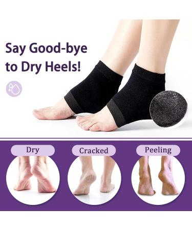 Moisturizing Gel Socks for Cracked Heels Treatment - Open Toe Silicone Spa Socks for Dry Feet Care (2 Pairs - Black & Gray) - Perfect for Women - Buy Online on GoSupps.com