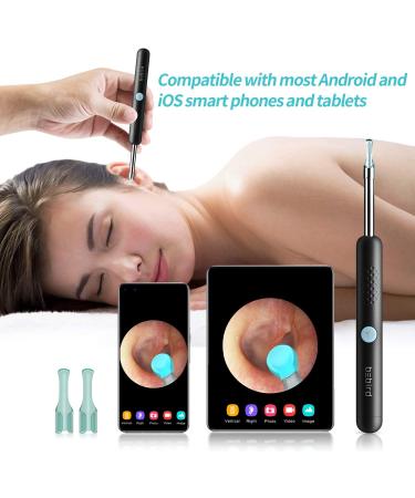1080P FHD Wireless Earwax Removal Tool with Camera | Ear Otoscope Cleaner for Android, iPhone & iPad - Buy Online on GoSupps.com