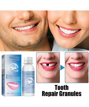 Xirujnfd Tooth Repair Granules - Cavity Filler Kit for Chipped Teeth & Temporary Fillings (1PCS) | Moldable False Teeth Solution - Buy Online on GoSupps.com