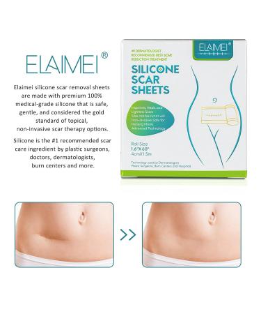 Meinuo Silicone Scar Sheets - Roll Scar Tape for Safe & Painless Scar Removal - 1.6 x 120 - Ideal for Body, Burn, C-Section, Keloid, Acne, Surgery - Buy Online on GoSupps.com