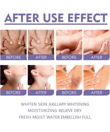 Whitening Skin Balm Armpit Knees Elbows Whitening Skin Stick Dark Spot Corrector Cream Body Moisturizing Brightening Stick Dark Elbows and Knees Lightening Natural Underarm Lightening Cream - Buy Online on GoSupps.com