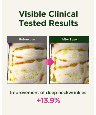 CKD Anti-Aging Eye & Neck Care Bundle Retinal + Collagen Creams with Gua Sha Roller for Wrinkles Dark Circles & Firming - Buy Online on GoSupps.com