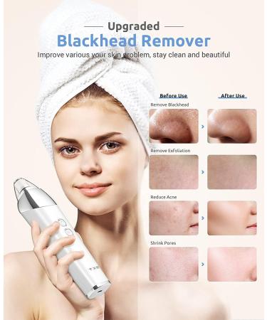 Blackhead Pore Vacuum Cleaner Remover | Upgraded 2023 Electric USB Rechargeable Extractor with 5 Probes | Blackhead Remover Kit for Women & Men - Buy Online on GoSupps.com