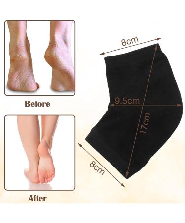 5Pairs Moisturizing Socks for Cracked Heel Scettar Moisturizing Gel Heel Socks Cracked Heel Gel Lined Infused Toeless Spa Sock Toeless Spa Socks for Women Soft Cotton Silicone Ventilate Heel Sleeves - Buy Online on GoSupps.com
