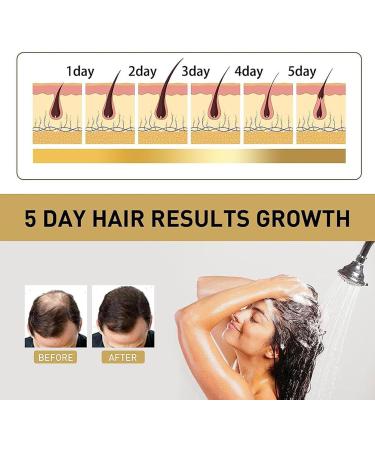 Japanese Shampoo and Conditioner for Hair Loss - 300ml - Japanese Cherry Blossom Shampoo for Hair Loss and Dandruff Removal - Buy Online on GoSupps.com