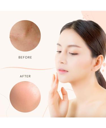Sensitive Skin Then Use Vitali-Chi Derma Soothe Skin Lotion+ 100ml - Buy Online on GoSupps.com