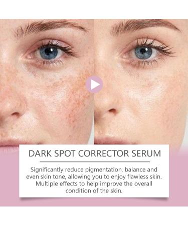 Dark Spot Correcting Glow Serum Dark Spot Corrector for Face Freckle Corrector Hyperpigmentation Treatment Skin Brightening Gel Cream for Sun Spots - Buy Online on GoSupps.com