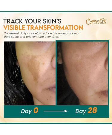 Carotis Dark Spot Corrector - 1 fl oz / 30 ml - - Buy Online on GoSupps.com
