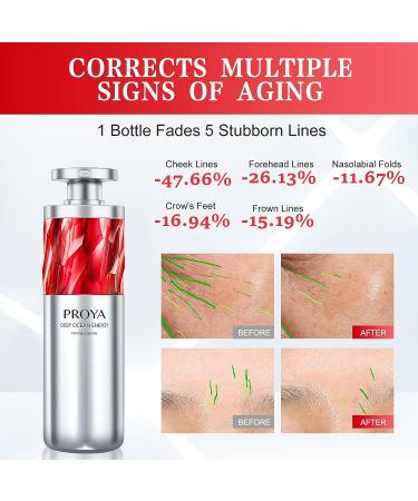 PROYA Supramolecular Retinol Serum - Night Anti Aging Face Serum with 20% Hexapeptide-1 Solution | Reduce Wrinkles & Fine Lines, Hydrate & Firm Skin | 1oz - Buy Online on GoSupps.com