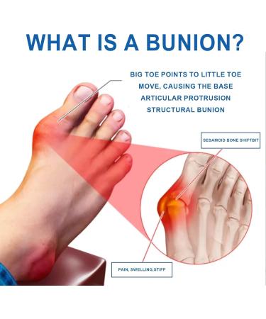Buy Hallux Valgus Socks | Toe Correction & Protection for Men & Women - Hammer Toe Relief 1 Pair Black - Buy Online on GoSupps.com