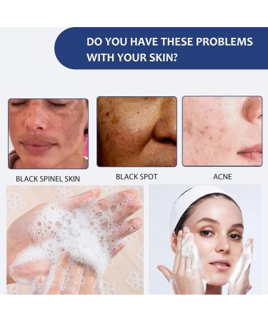 Cleansing Lotion for Acne & Spots & Acanthosis Nigricans Acanthosis Nigricans Cleansing Lotion Acanthosis Nigricans Therapy Cream Acanthosis Nigricans Therapy for All Skin Types - Buy Online on GoSupps.com