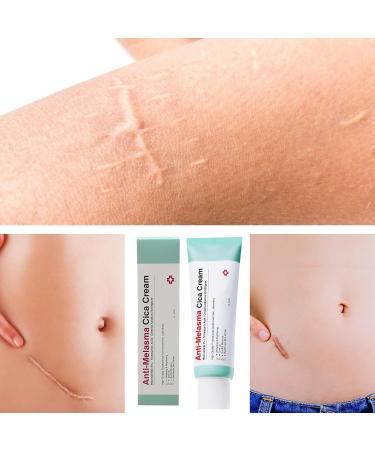 GkgWuxf Stain Remover For The Face For Women 40ml Cream Remove Old Scars Nourishing Brightening Repairing Beauty Lotion Everyone - Buy Online on GoSupps.com