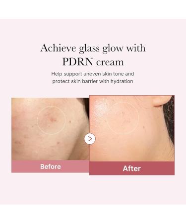 medicube PDRN Pink Hyaluronic Moisturizing Cream | Blemish Recovery Relief & Hydrating Care | Restores Skin Elasticity & Glow | Korean Skincare for Even Skin Tone & Pore Care | 50ml / 1.69 fl.oz. Rose PDRN (Vegan) 1.69 Fl  - Buy Online on GoSupps.com