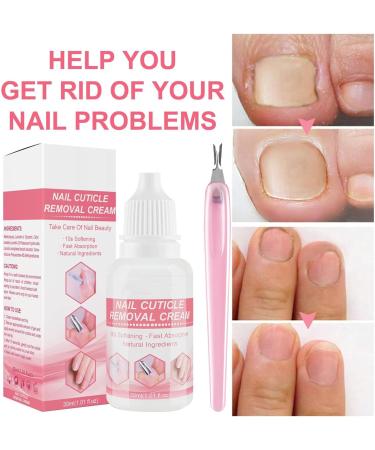 Cuticle Remover Cream | Cuticle Remover Gel 30ml Instant Fast Absorption Gentle Softening Cuticle Remover Cream Maintain Healthy Cuticles Honhoha - Buy Online on GoSupps.com