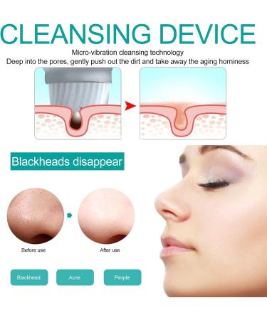 Facial Cleansing Machine Ergonomic Electric Facial Cleansing Brush for Cleaning Grease for Cleaning Dirt for Cleaning Skin for Opening Clogged Pores (White) - Buy Online on GoSupps.com