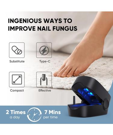 Buy Nail Fungus Light Device for Home Use - Treat Onychomycosis on Fingernails & Toenails | Effective for Damaged Discolored & Thickened Nails - Buy Online on GoSupps.com