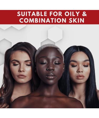 Acnetame Acne Pills 30 Day Treatment for Clear Skin - 30 Servings (Pack of 1) - Buy Online on GoSupps.com