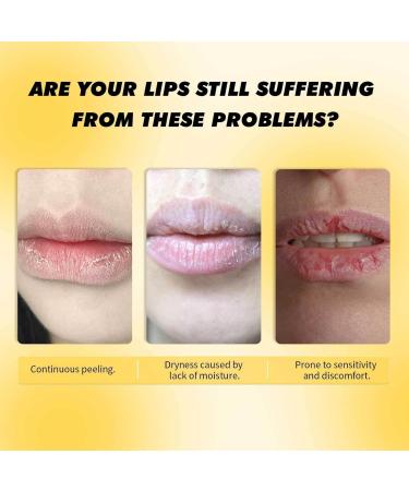 Nourishing Lip Balm Honey Lip Balm Moisturizes for Dry Cracked Lips Lightens Lip Lines Enhances Lip Color Daily Lip Moisturizer - Buy Online on GoSupps.com