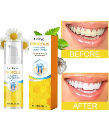 Propolis Mouthwash for Total Oral Care - Deep Cleaning & Teeth Health - 60ml (3PC) - Hydros Natural Solution - Buy Online on GoSupps.com