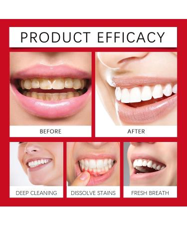 Daily Care Toothpaste - Gentle Cleaning Reduces Yellow Stains & Bad Breath Freshens Breath Daily Teeth Protection(2PCS) - Buy Online on GoSupps.com