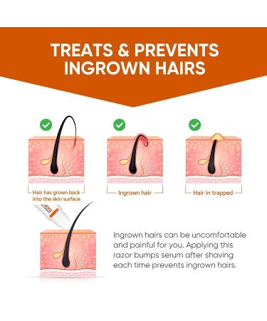 Ingrown Hair Treatment & Razor Bumps Stopper Serum - Alcohol-Free After Shave Solution for Men and Women - Face, Neck, Bikini, Legs, and Underarms - Buy Online on GoSupps.com