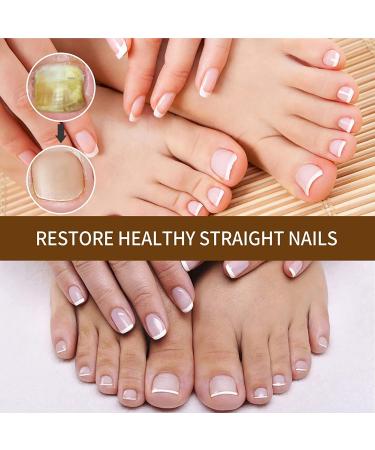 NailGrowth DeepHealing Organic Serum NailGrowth Nail Serum Reconstrux Nail Growth Nail Growth and Strengthening Serum Nail Serum for Growth and Repair for Damaged Nails (1PC) - Buy Online on GoSupps.com