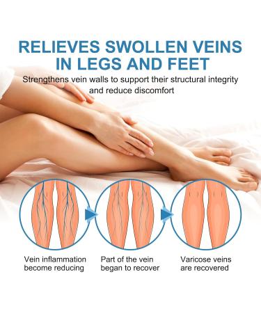 Shantou Youjia Variant Veins Spray Cream against spider veins and vein care fade cream spray against spider vein for radiant skin Skin Revealing and Care for Varicose Veins Location care spray 30 ml - Buy Online on GoSupps.com