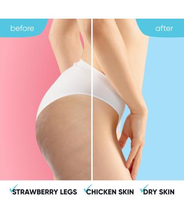 Estetist KP Bump Eraser Body Scrub | Keratosis Pilaris & Ingrown Hair Treatment | 10% AHA Glycolic Acid Exfoliant for All Skin Types - Buy Online on GoSupps.com