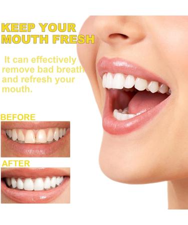 Propolis Oral Instant Treatment Spray | Furzero Propolis Oral Health Spray & Teeth Total Care Mouthwash - Buy Online on GoSupps.com