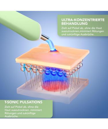 Buy Foreo Flawless & Fabulous Espada 2 SET - LED Light Therapy & Blemish Solution - FDA Approved Scar Treatment for Anti-Pimples | International Shipping Available - Buy Online on GoSupps.com