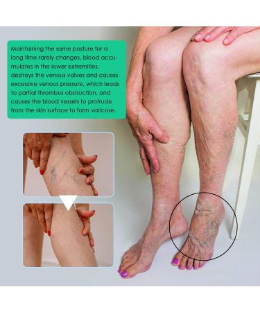  Katutude Veinopro Varicose Veins Treatment Soaps for Legs and All Skin Types (2 Pack) - Buy Online on GoSupps.com