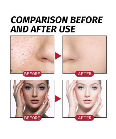 AHA BHA PHA 32% Liquid Exfoliant for Face High-Strength Multi-Acid Peel to Help Refine Skin Texture Enhance Radiance and Support a Smoother-Looking Complexion Suitable for All Skin Types 1 fl oz - Buy Online on GoSupps.com