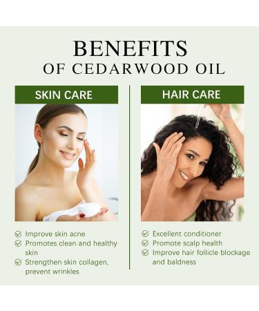 Aoruilia 10ml Cedarwood Essential Oil 100% Pure Natural Cedarwood Oil Essential Oils for Diffuser for Home Aromatherapy Bath Relax Soaps & Candles Making Cedarwood 10 ml (Pack of 1) - Buy Online on GoSupps.com