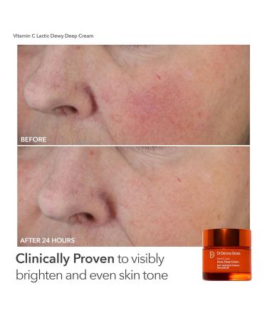 Dr Dennis Gross dpl FaceWare Pro LED Device Boost Collagen Brighten & Firm Kit Pink LED Mask Cleansing Oil Dewy Deep Cream & 5 Universal Daily Peels | $592 Value Gift Set - Buy Online on GoSupps.com