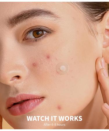 Buy Pimple Patches for Face - Hydrocolloid Acne Strips with Salicylic Acid & Tea Tree Oil - Effective Blemish & Pore Cleansing for All Skin Types - Buy Online on GoSupps.com