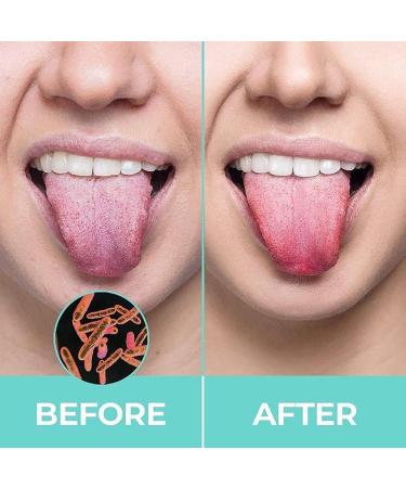 Buy Wmool Steel Tongue Cleaner - Stainless Metal Toothbrush for Oral Hygiene | Adult Tongue Scraper & Brush - Buy Online on GoSupps.com