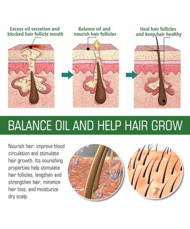 Care Essence for Dry Hair - Rosemary Oil Hair Growth Supplement (2.02 fl. oz) | Repair & Nourish Your Hair - Buy Online on GoSupps.com