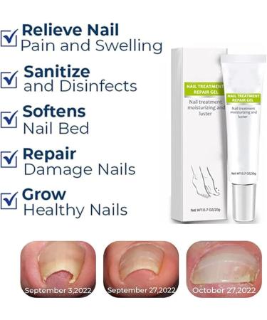 DUBUSH 2023 Removal Paronychia Gel Nail Nail Treatment Repair Gel Instant Beauty Gel for Nail Growth Care Anti Paronychia Relief Cream Toe and Fingernail Repair 5 pieces - Buy Online on GoSupps.com