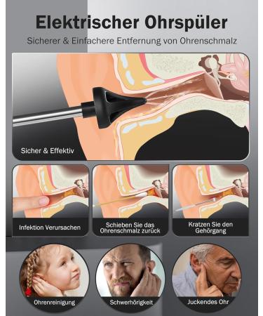 Hommie Ear Wax Remover Rechargeable Electric Ear Cleaner with 4 Modes IPX7 Waterproof Foldable Nozzle & 4 Replacement Tips International Shipping Available - Buy Online on GoSupps.com
