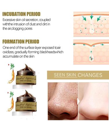 CRIVERY 2PCS Pro-Herbal Peel-Off Facial Mask Set - 2023 New Blackhead Remover & Skin Care Treatment - Buy Online on GoSupps.com