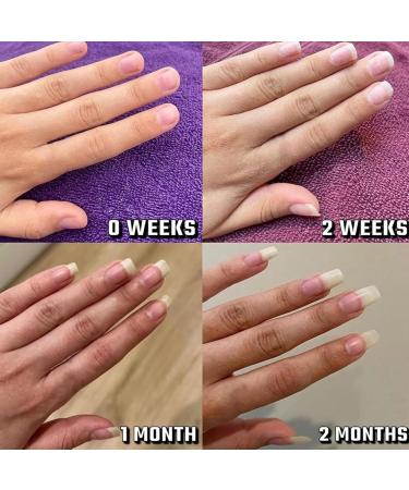 Lyra Cosmetic Ongles Huile Cuticules Ongles Huile de Croissance des Ongles Rayonnante S rum Cosm tique for Hydrater Renforcer et claircir Le Soin des Ongles(3pcs) - Buy Online on GoSupps.com