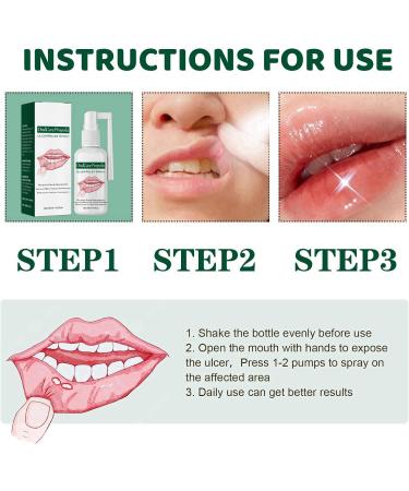 Mouth Ulcer Treatment Spray Mouth Ulcer Treatment for Adults Canker Sore Treatment Oral Care Spray Herbal Mouth Spray Canker Sores Relief Spray for Mouth Ulcer Bad Breath Treatment Mouth Freshener - Buy Online on GoSupps.com