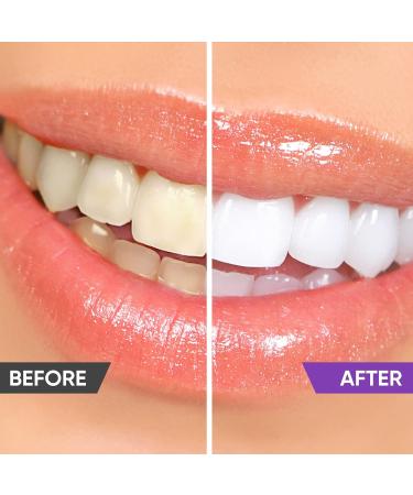 Purple Toothpaste for Teeth Whitening  Teeth Whitener  Whitening Toothpaste for Tooth Stain Removal  Fights Bad Breath 30 - Buy Online on GoSupps.com