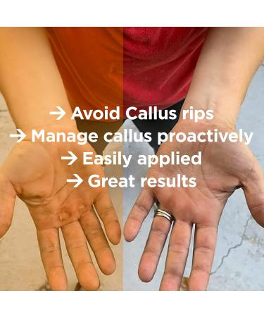 Jumbo Callus Healing Salve for Hands and Feet - Prevent Bleeding and Moisturize Calluses for Gymnastics, Weight-Lifting, Crossfit, Rock Climbing, and Rowing - Buy Online on GoSupps.com