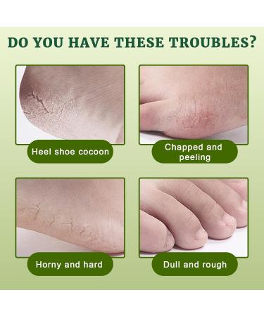 2 Paires Masque Pied Masque Peeling Exfoliant Pieds Masque Exfoliant Pied Pour Enlever Les Callosit s Aloe Vera - Buy Online on GoSupps.com