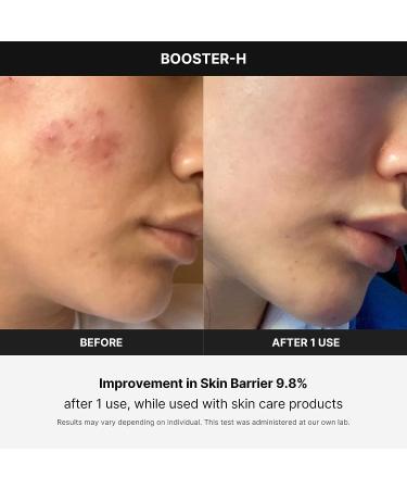 Medicube Age-R Booster-H - Powerful Anti-Aging Serum - Buy Online on GoSupps.com